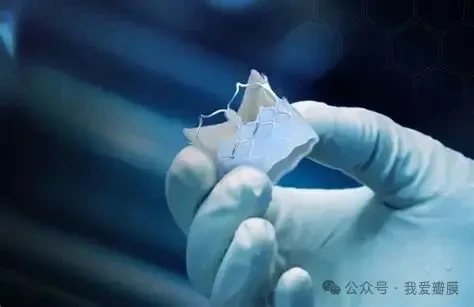 Anteris touts first successful DurAVR valve-in-valve implant