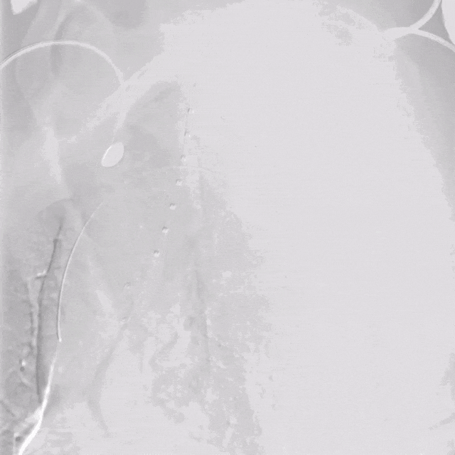 undefined 4、胸主造影.gif