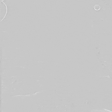 undefined 2、猪尾导管前往升主动脉途中造影,明确位置.gif