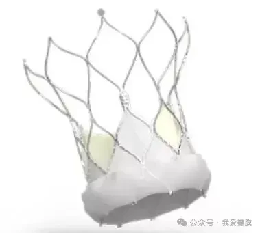 填补市场!雅培Navitor TAVR 系统获CE 认证-中国网