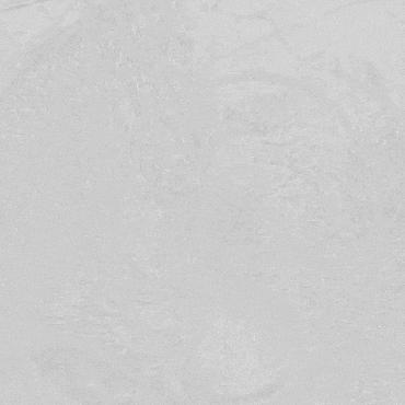 undefined 1术前造影.gif