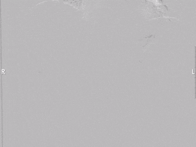 image11.gif