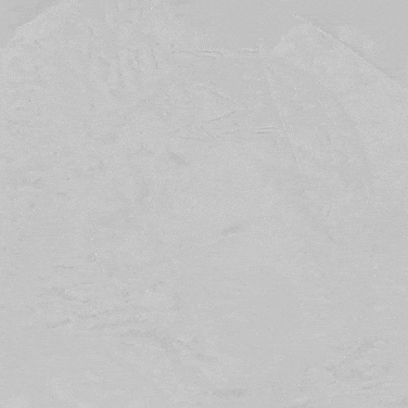 undefined 5释放后造影.gif