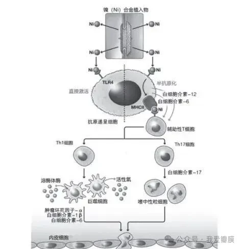 镍合金医疗器械过敏的研究进展_检测资讯_嘉峪检测网