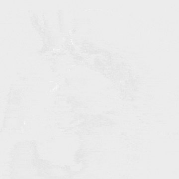 undefined 9术后造影.gif
