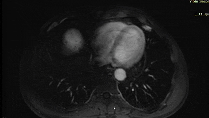 3.gif