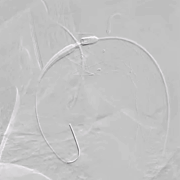 undefined 6LSA置入翻山鞘.gif
