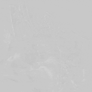 undefined 15术后造影.gif