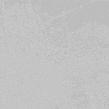 undefined 13置入10-39mm球扩式覆膜支架.gif