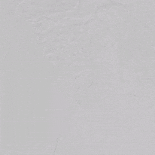 undefined 3、右髂外动脉狭窄.gif
