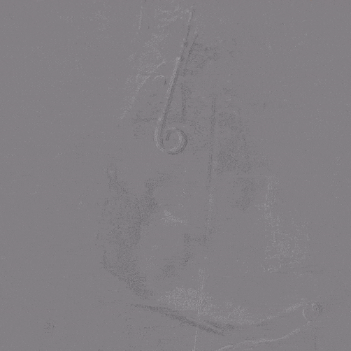 undefined 2、术前胸主造影2.gif