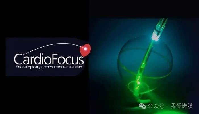 CardioFocus launches HeartLight in U.S. - MassDevice