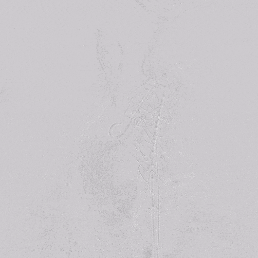 undefined 11 最后造影.gif