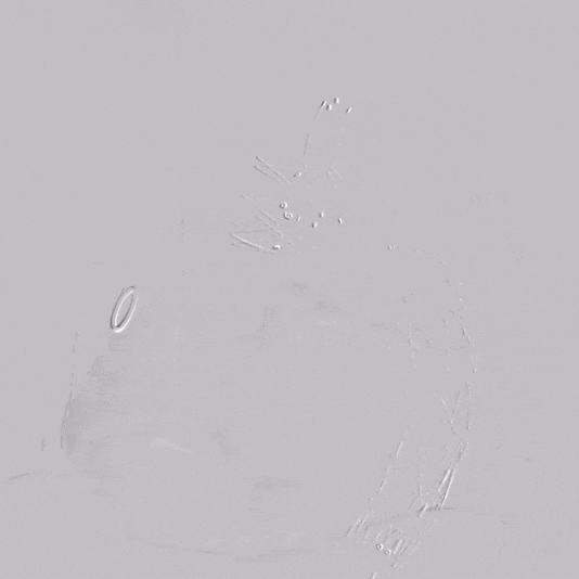 undefined 29、术后造影LAO.gif