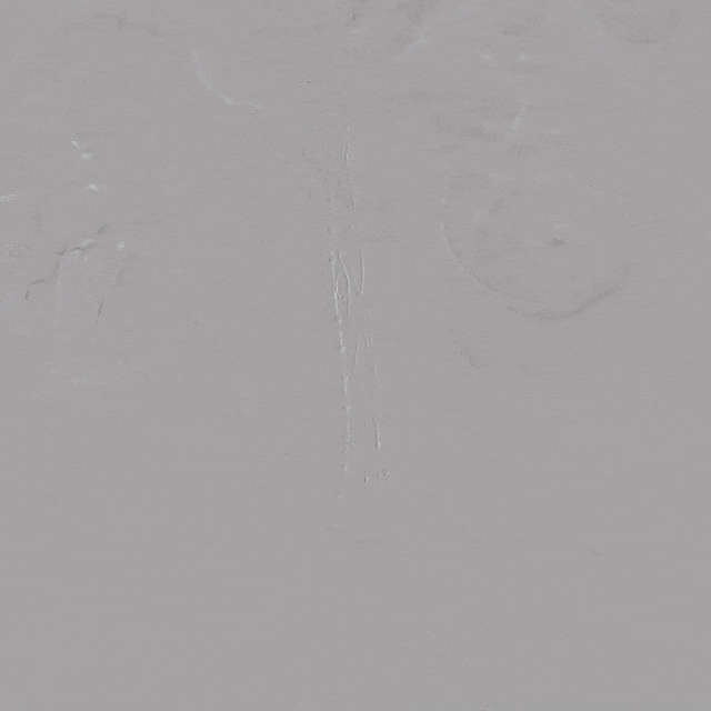 39 整体造影.gif