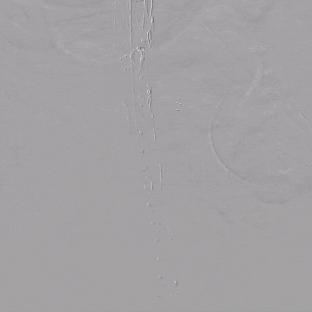 28 腹主造影.gif