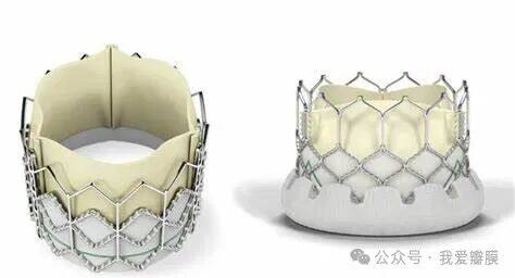 FDA Approves Edwards' SAPIEN 3 Ultra Transcatheter Heart Valve - iData ...
