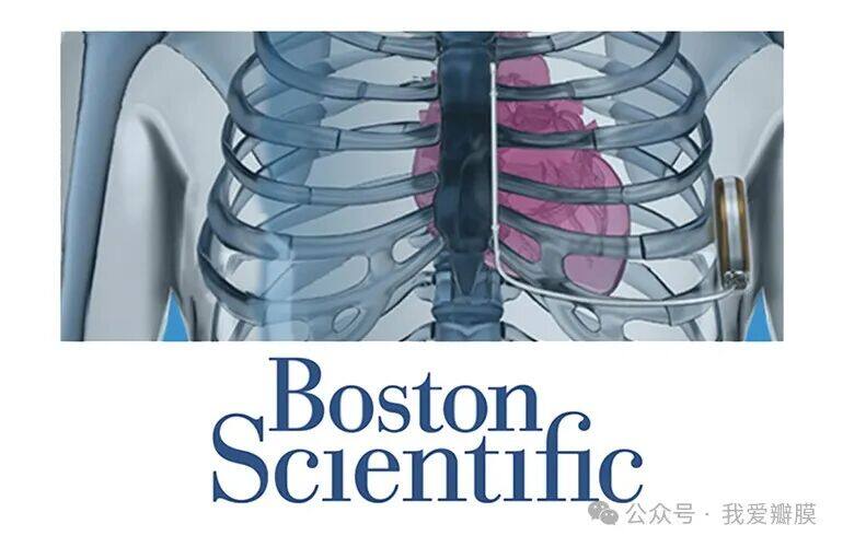 Boston Scientific has another serious recall on the same heart device ...