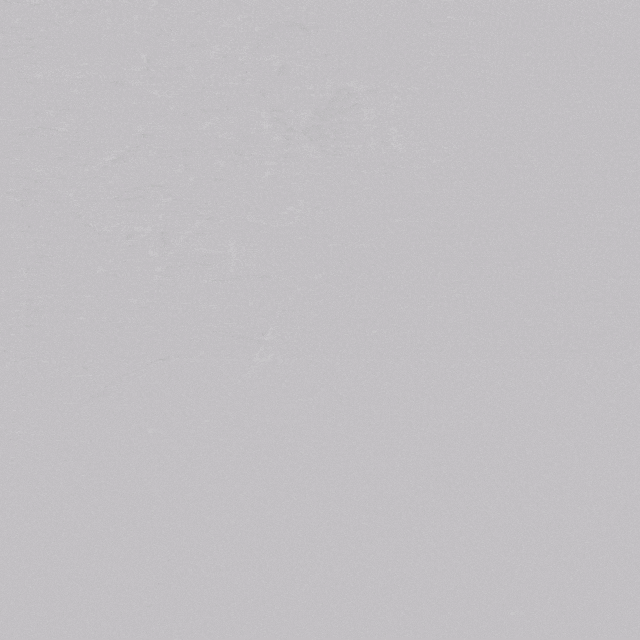 undefined 3、造影示位于真腔且狭窄.gif