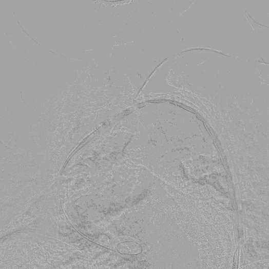 undefined 3 置入华脉.gif