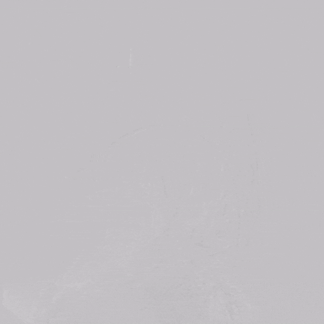 undefined 1 术前造影.gif