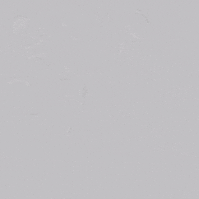 undefined 5、逐步导入猪尾导管至升主.gif