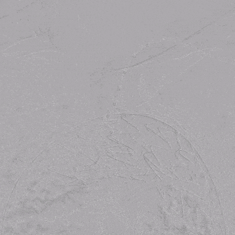 undefined 5 LSA造影.gif
