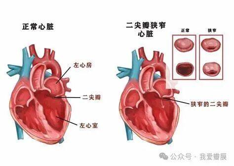 金山这家医院无需开刀即可治疗心脏瓣膜疾病!_澎湃号·政务_澎湃新闻-The Paper