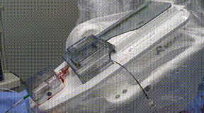 06.手术机器人辅助颈动脉支架递送.gif