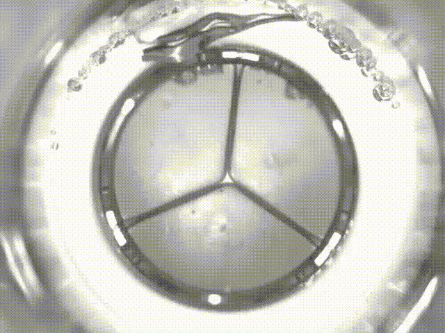 心岭迈德高分子外科瓣膜视频 00_00_00-00_00_30.gif