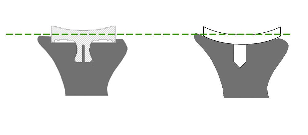 inset_vs_onlay-1.png