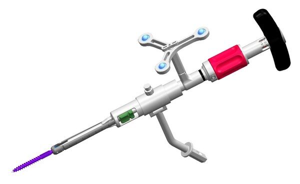 强生医疗的微创内植入系统Viper Prime(TM) 强生医疗的微创内植入系统Viper Prime(TM)