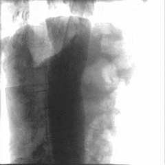 3.gif