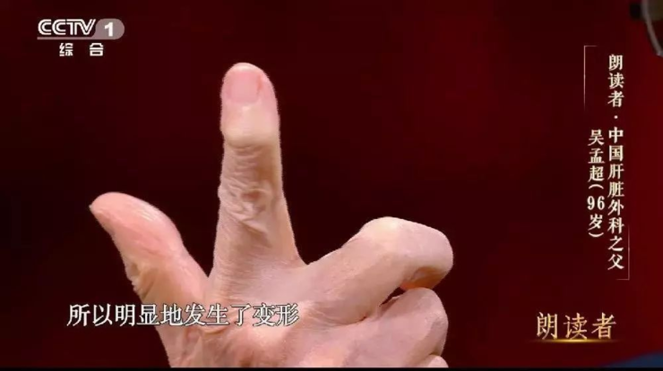 美敦力“雨果”机器人辅助手术系统首次用于妇科手术