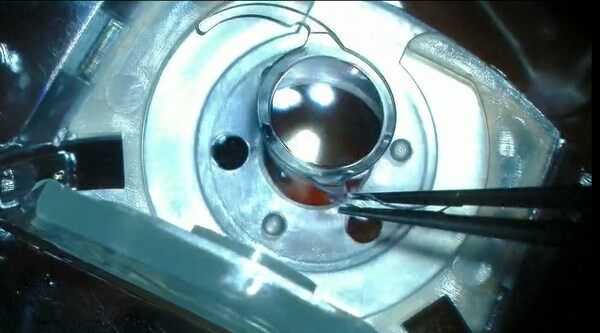 强生眼力健新一代增效型连续视程人工晶状体系列产品