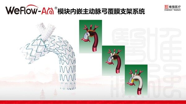 WeFlow-Arch®模块内嵌主动脉弓覆膜支架系统 WeFlow-Arch®模块内嵌主动脉弓覆膜支架系统