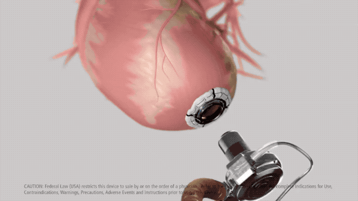 v2_99addc3589c848ef873752a50af6551a_img_000.gif