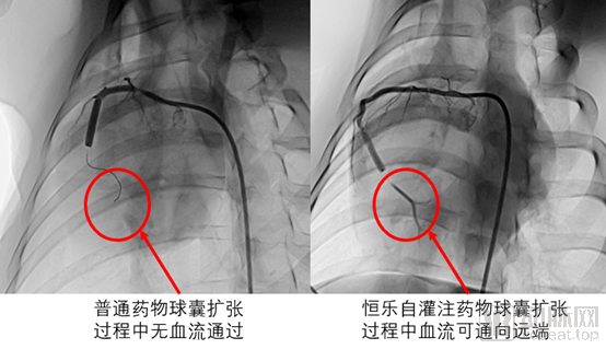 恒升1.png