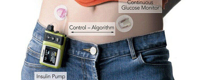 ArtificialPancreaseHeader.jpg_1024_副本.jpg