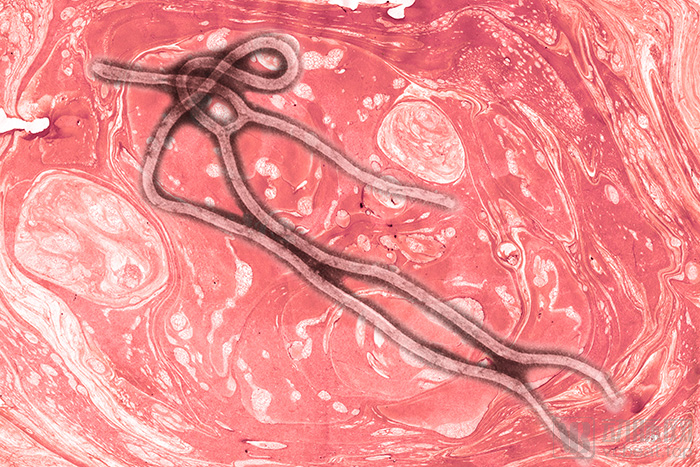 ebola.jpg