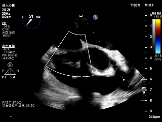 2.gif