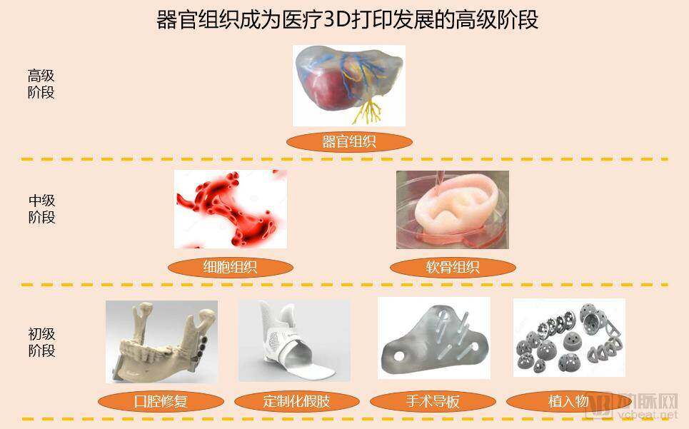 3D打印发展.png