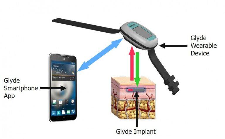 Glyde-System-768x476 (1).jpg