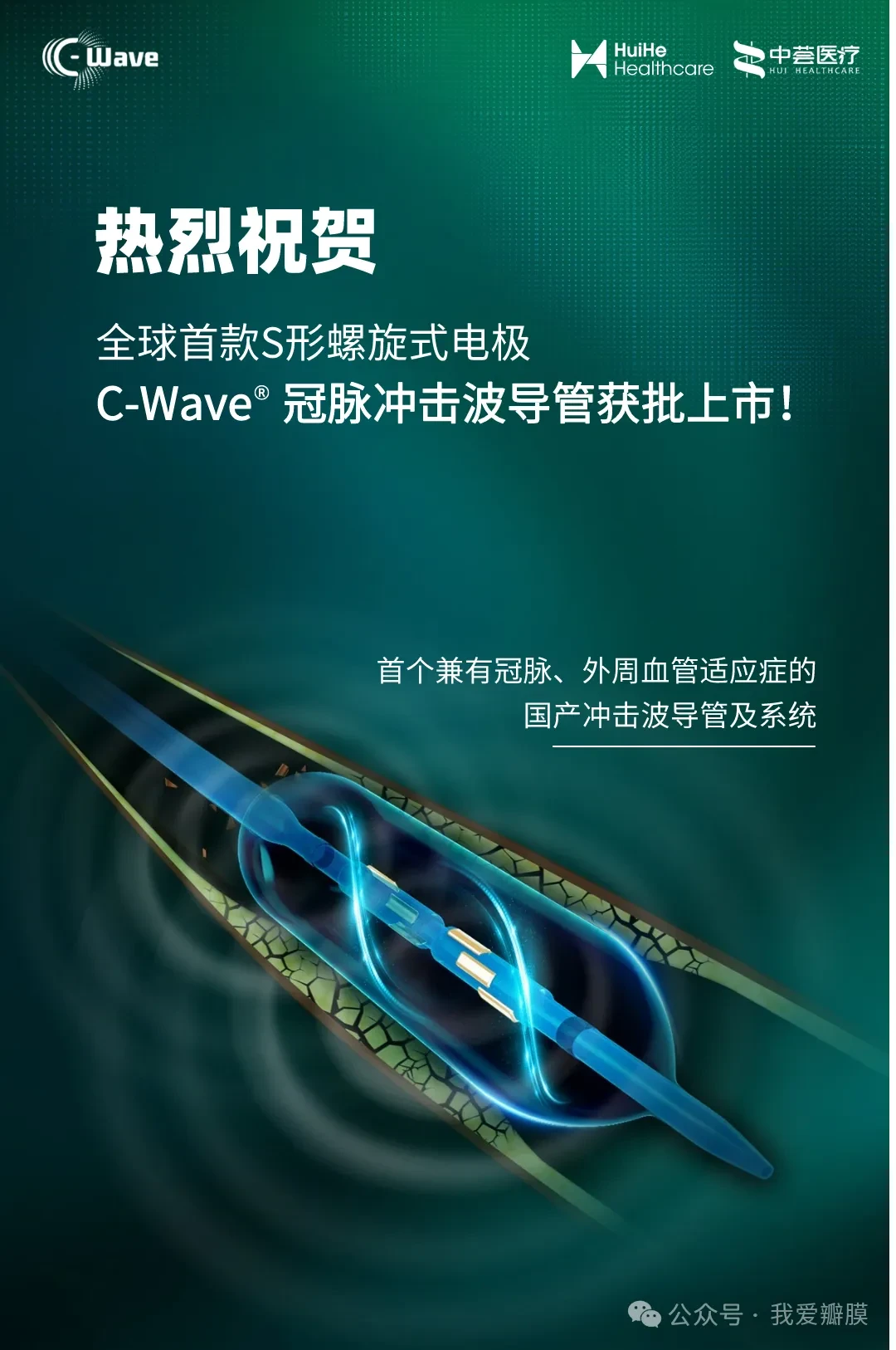 祝贺！汇禾医疗C-Wave®冠脉冲击波导管获批上市！_