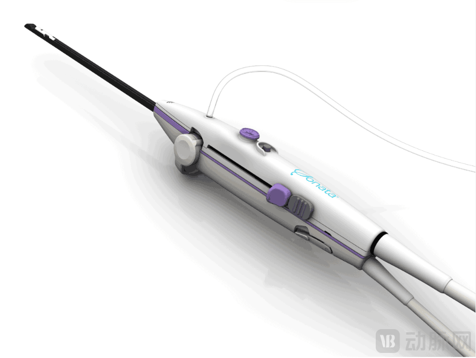 Sonata系统 图源Gynesonics官网.png