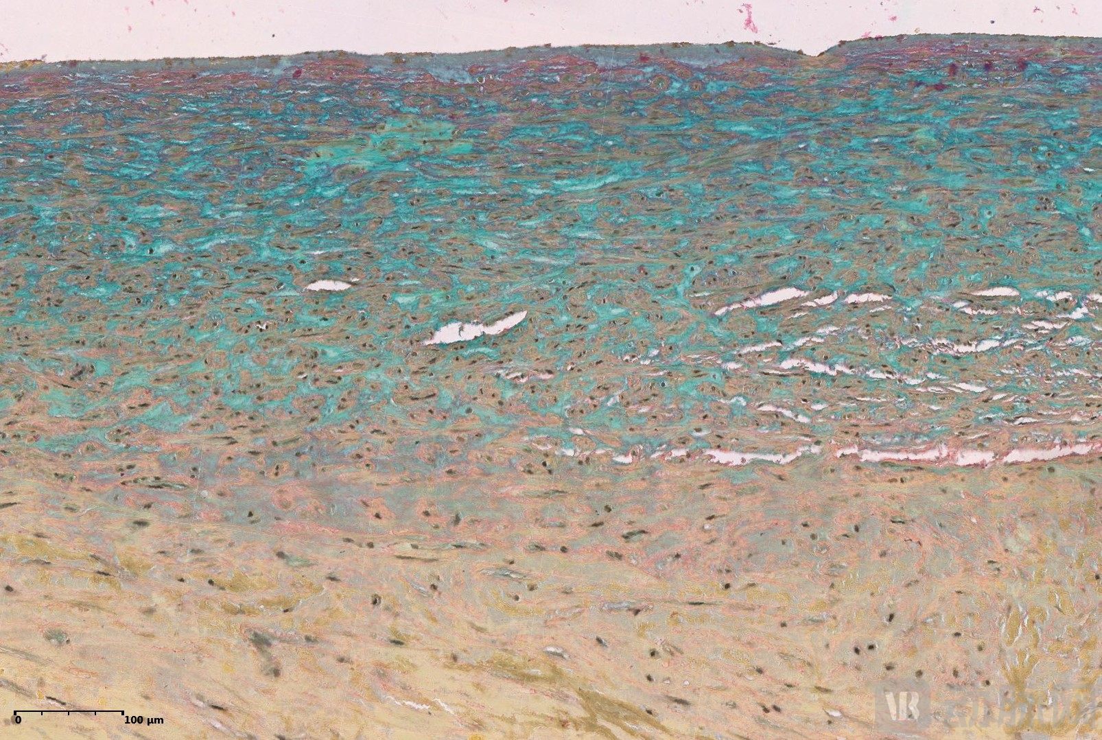 5. 心脏瓣膜石蜡Movat 100×.jpg