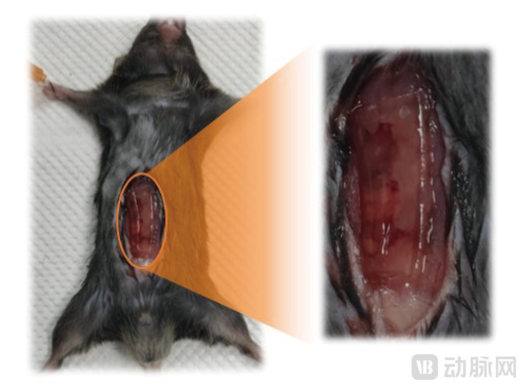 动脉网图片_画板 1.jpg