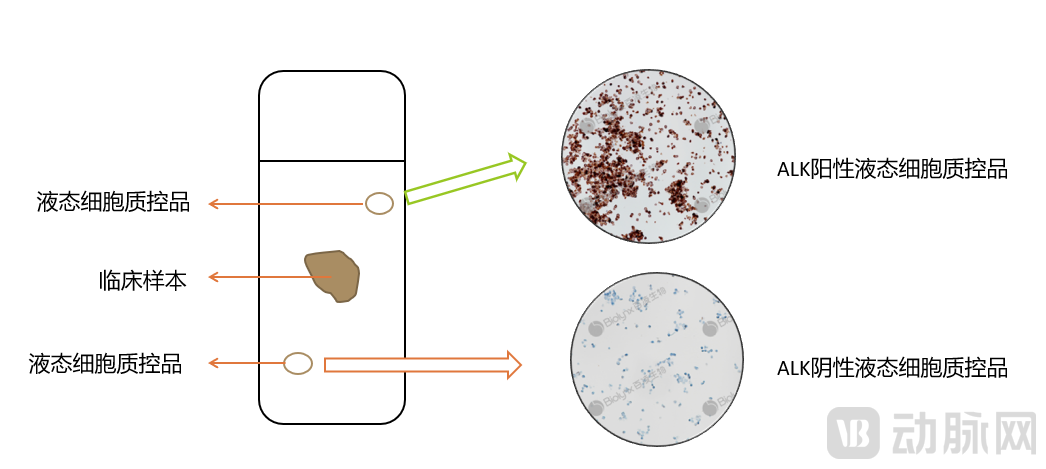 液态细胞质控品配图2.png