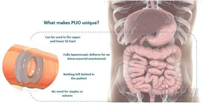 Plio surgical的磁性吻合器Plio的优势 图源Plio surgical官网.jpg