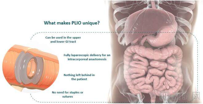 Plio surgical的磁性吻合器Plio的优势 图源Plio surgical官网.jpg